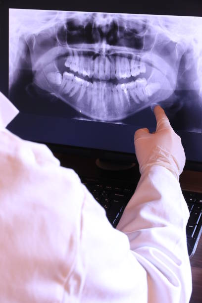Best Emergency Dental Extractions in Redding, CA