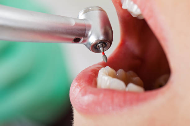 Best Pediatric Emergency Dentist in Redding, CA